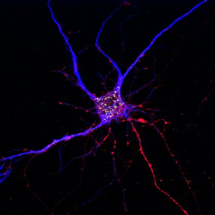 A potential drug target for Alzheimer’s disease has been discovered, affecting both neurons and brain immune cells.